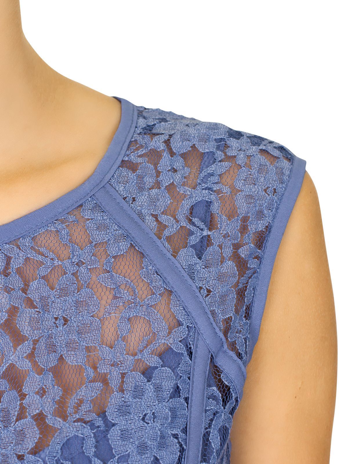VIVE MARIA Blue Lace Dress